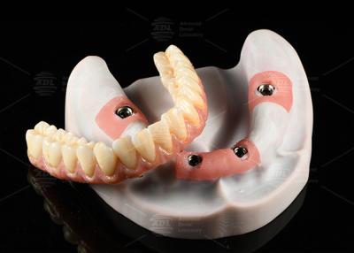 China Composite Pink Porcelain Crown A1 Shade All On 4 Hybrid Titanium Screw Retained for sale