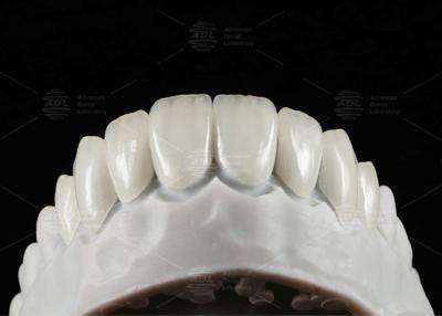 China Carillas dentarias de EMAX prensadas naturales 16 tonos en venta