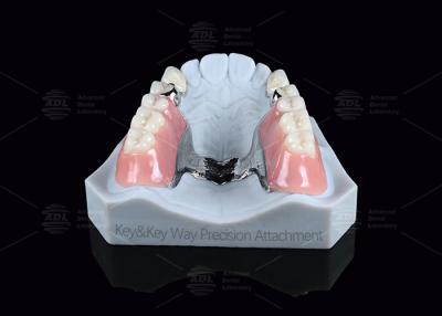 Cina Chiave d'argento e porta chiavi facile manutenzione precisione attacco dentale in vendita