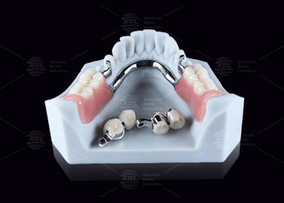 Cina CEKA M2 Precision Attachment Titanium con spazi orizzontali / verticali di 3 mm in vendita