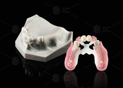 China Biocompatibiliteit Tandheelkundige Telescoop Wit Inner Zirconia Buiten Peek Telescoop Tandheelkundige Te koop