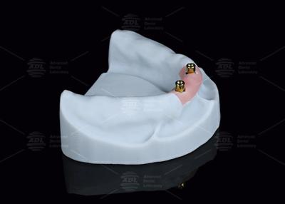 China Titanium Locator Dental Attachments For Overdentures In Silver And Gold Finish for sale