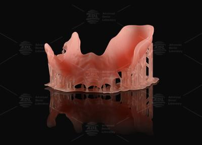 China Orange Pink Acrylic Partial Denture Natural Looking 3d Printing Digital Dentures for sale