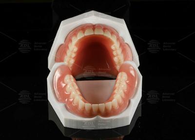 China Alta estética Dentadura removível completa acrílica Dentadura completa acrílica à venda