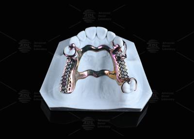 Китай Чувствительная кожа Высокопрочная титановая рама 3D-печать продается