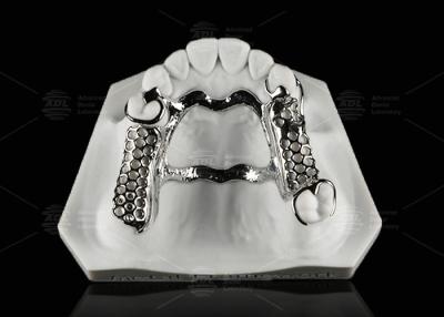 China Repairable Cobalt Chromium Dental Metal Framework Partial Denture for sale