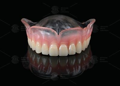 China Vertex Clear And Pink Full Denture Virtually Unbreakable Affordable Partial Dentures for sale