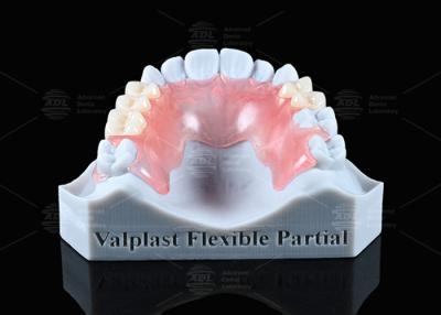 China Aparência natural Valplast Dentadura parcial Longevidade Altamente resistente a fraturas à venda