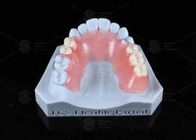 China TCS Flexible Resistente a manchas parcialmente libre de BPA Dentaduras parciales para un aspecto natural en venta