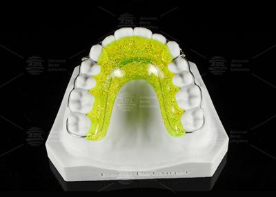 China Custom Fit BEGGS RETAINER Orthodontic For Teeth Alignment Easy To Clean for sale