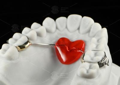 Chine Appareil d'orthodontie en acier inoxydable à vendre