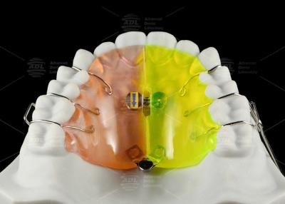 China Orthodontic Fan Shaped Expander Provides Posterior Crossbite Free Section Expansion for sale