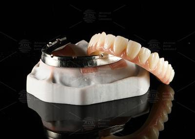 Cina Traslucido Ponte di zirconia a contorno completo su barra di impianto fresata Disegno personalizzato in vendita