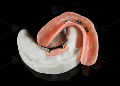 China Titanium legering Snap On Dolder Implantat Bar Overdenture Gepolijst Voor Natuurlijke Glimlach Te koop