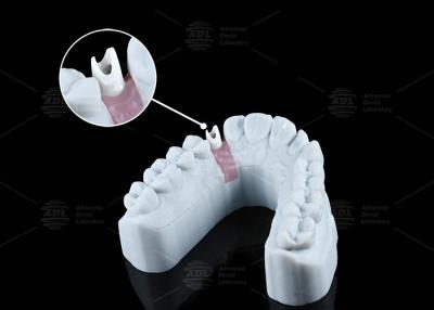 중국 흰색 맞춤 Zirconia Abutment 자연스러운 외모 미학 및 최적의 기능 판매용