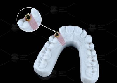 중국 유니버설 앵글 스크루 채널 CAD / 캠 시스템과 호환 판매용