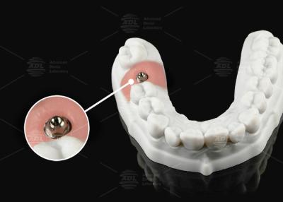 China Silver Gold Titanium Multi Unit Abutment For Single Or Multi Unit Prosthetic Platform for sale