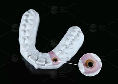 China Internal Hex Custom Titanium Abutment Screw Cement Retained Varying Shape for sale