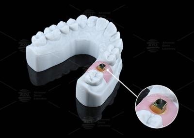 China Customized Titanium Base Corrosion Resistance Dental Implants And Solutions for sale