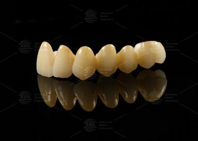 China Strong Aesthetic Porcelain Fused To Zirconia For Natural Looking Restorations for sale