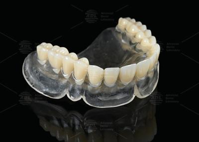 China Heat Curing Vertex Thermosens Dentures For Clear Full Denture Wearers for sale