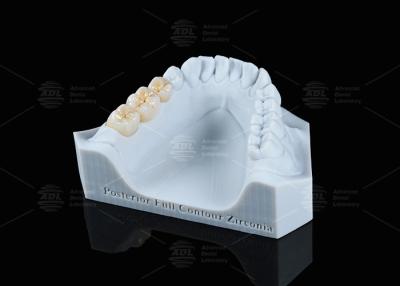 China Translucency White Full Contour Zirconia Crown FCZ Monolithic Zirconia Crown Easy Milling for sale