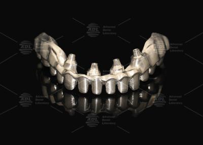 China Hybrid Pink Porcelain Implant Crown Malong Full Arch Implant Bridge Immediate Loading for sale