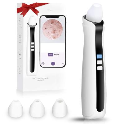 China JOSUNN Acne Treatment Good Selling Facial Pore Comedones Facial Acne Nosal Blackhead Remover Real Time Visual Skin-Friendly Vacuum for sale