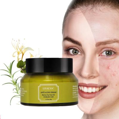 China Natural Skin Revitalizer Private Label Facial Skin Care Herbal Tea Tree Oil Whitening Scars Removal Anti Acne Face Cream for sale