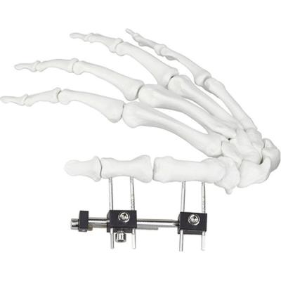 China Factory Price Mini Palm Fragment Orthopedic Finger External Fixator MED-116-4 for sale