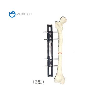 China Bone Lengthening Device--B Hoffman Pin Type External Fixator MED-E001 for sale