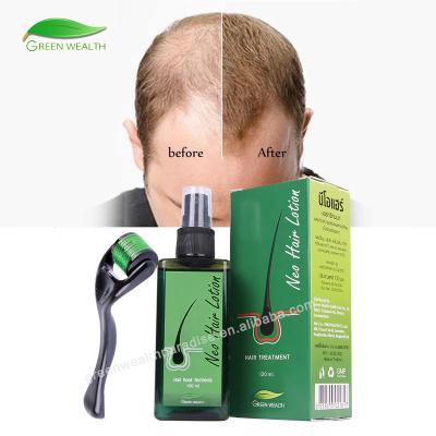 China Neo Loss Prevention Hair Lotion Original Made in Thailand No Side Effects Hair Treatment Fast Hair Growth Serum for sale