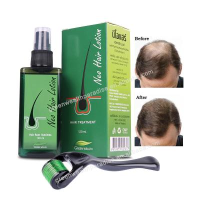 China Hot Sale 120ML Thailand Hair Loss Prevention Neo Green Lotion Wealth Fast Growth Hair Oil For Men And Women for sale