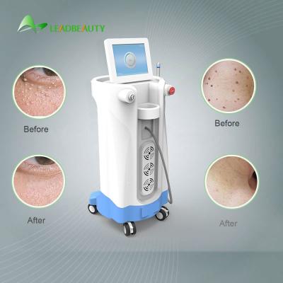 China 980nm Diode Laser Spider Vein Removal Machine For Blood Spider clearance for sale