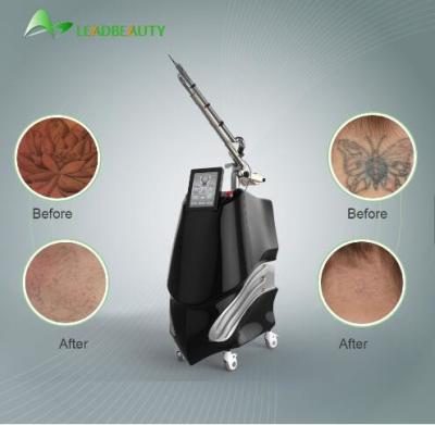 China Acne removal; Tattoo removal Q-switched 1064/532nm nd yag pico second  laser for tattoo removal beauty equipment for sale