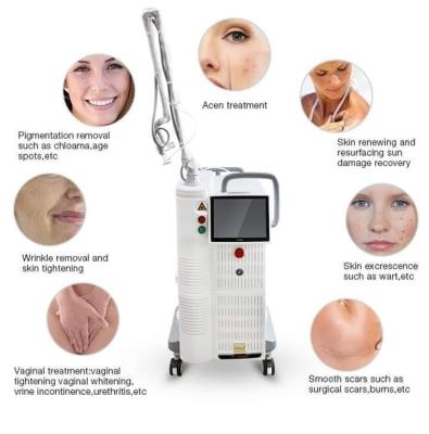 China Dark Circles Fraxel Laser 4D Fontona Machine For Skin Rejuvenation And Pigment Removal for sale