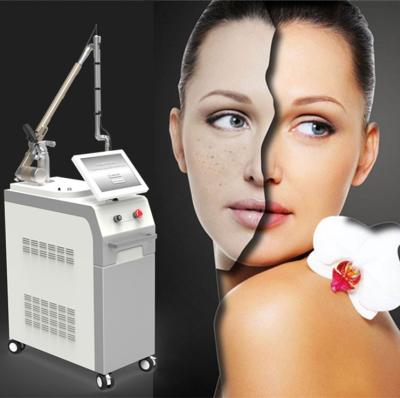 China 2018 high quality q-switched nd yag laser tattoo removal machine nd yag laser machine for sale