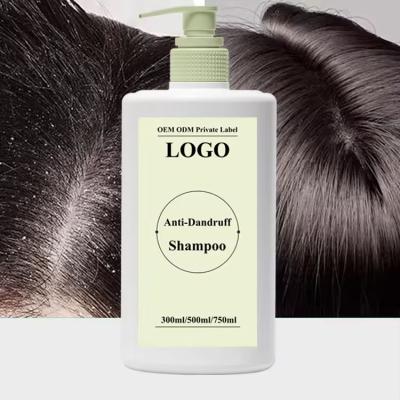 China Oil Control Anti Dandruff Anti Itchin Shampoo Deep Cleansing Hair Shampoo for sale