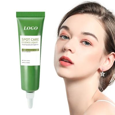 China Limpeza Profunda Reparação Anti-Acne Fade Acne Mark Creme de Tratamento de Acne à venda