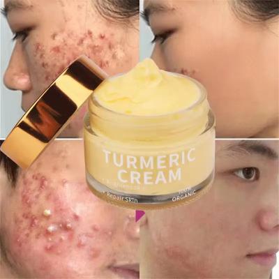 China Organic Skin Care Acne Wrinkle Dark Spot Moisturizer Bleaching Turmeric Face Cream for sale