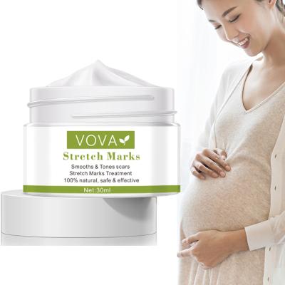 China Wholesale Pure Natural Organic VOVA Mark Skin Revitalizer Anti Stretch Skin Revitalizer For Loose Line Best Abdomen Pregnancy Repair Scar Stretch Mark Cream for sale