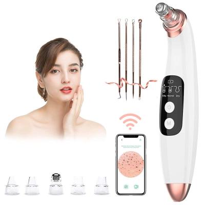 China Visual Acne Treatment Blackhead Remover Vacuum With Camera, Electric Comedone Acne Extractor Kit USB Rechargeable Blackhead Suction Tool for sale