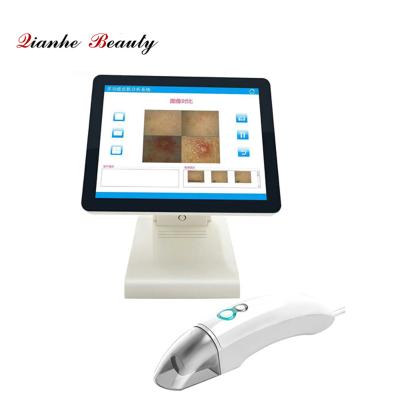 China Updated Version Skin Wrinkle Analysis Touch Screen UV Light Skin Analyzer Skin Scope Facial Machine For Face for sale