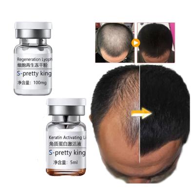 China Hair Growth Serum Sets Kits Anti-Hair Loss Hair Treatment Stimulating Treatment Hair Care Essence for sale