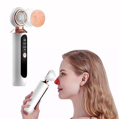 China Acne Treatment Supper Market OEM Blackhead Vacuum Detergent Acne Blackhead Pore Vacuum Remover with visible window and built in bettery for sale