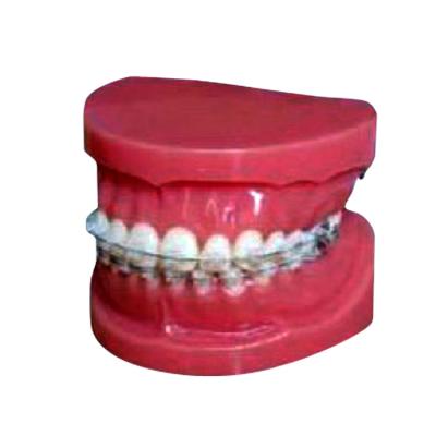 China Dental Regional Dental Brace Ceramic Study Model With Fixed Braces On Teeth (Normal) for sale