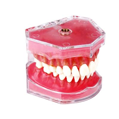 China Dental medical school gum model with removable teeth for sale