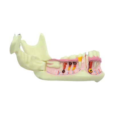 China Dental Faculty of Medicine Teeth Teaching Model Teeth And Jaw Mandible With Hinge Oral Model for sale