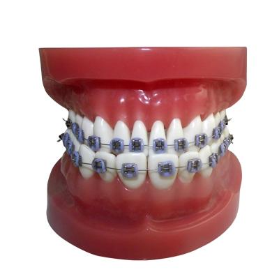 China CE approved medical school study model with fixed braces on (normal) teeth for sale