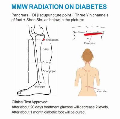 Cina Macchina elettromagnetica di terapia del piede di trattamento diabetico di dolore con 30GHz - frequenza 45GHz in vendita